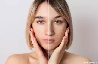 Kulit Kusam Bukan Akhir Dunia, Ini Tips Ampuh Bikin Kulit Glowing Lagi!