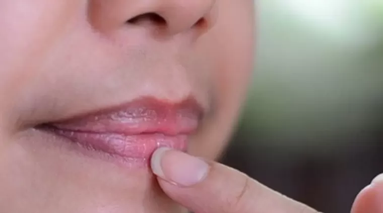 Penyebab Bibir Hitam yang Sering Diabaikan dan Cara Mengatasinya dengan Mudah