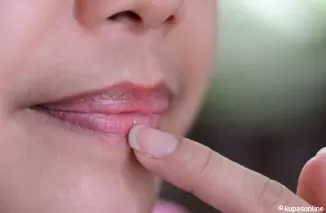 Penyebab Bibir Hitam yang Sering Diabaikan dan Cara Mengatasinya dengan Mudah