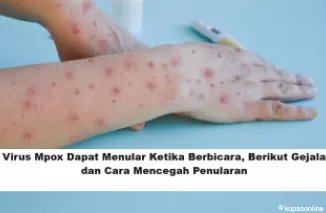 Virus Mpox Dapat Menular Ketika Berbicara, Berikut Gejala dan Cara Mencegah Penularan