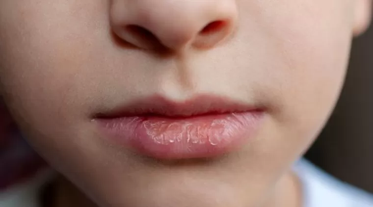 5 Tips Ampuh Agar Bibir Tidak Kering