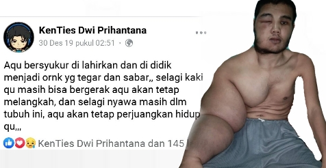 Tities, Selagi Nyawa Masih Dalam Tubuh Ini Aku Akan Tetap Semangat Dan Berjuang Hidup