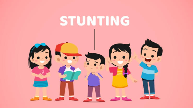 Ilustrasi stunting.